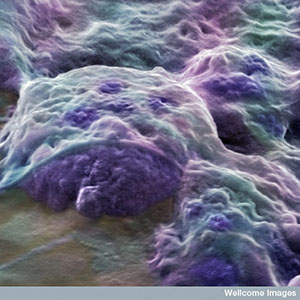 These embryonic stem cells, which come from a human embryo, can turn into any cell type. But they're hard to come by and can't be used to treat HD directly.