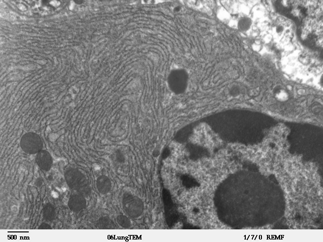 The wavy lines in this image are the "endoplasmic reticulum" of a cell - the storage depots for calcium. Ryanodine receptors are found on these structures.