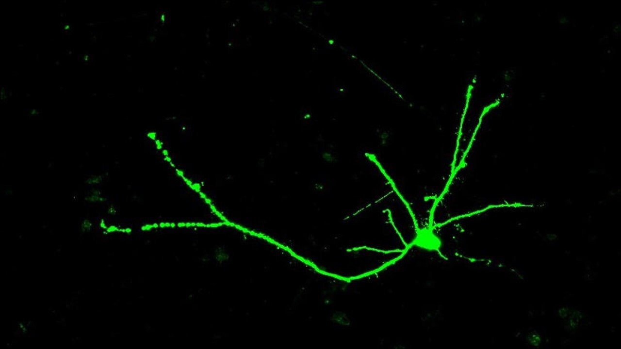 Nerve cells are shaped like trees - with a cell body that contains many branches at the top of the nerve cell, a long trunk, and a branched ârootâ system at the bottom of the cell.