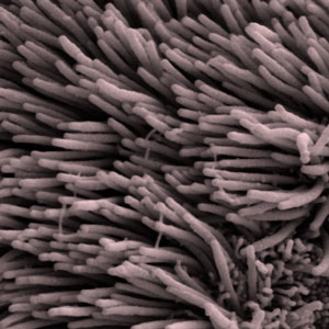 Cilia, seen here coating the cells lining the throat