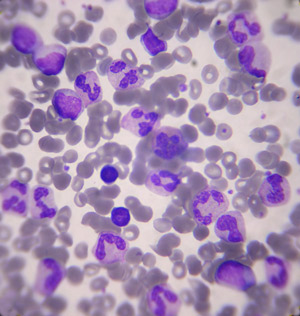 White blood cells are charged with defending the body from invading germs