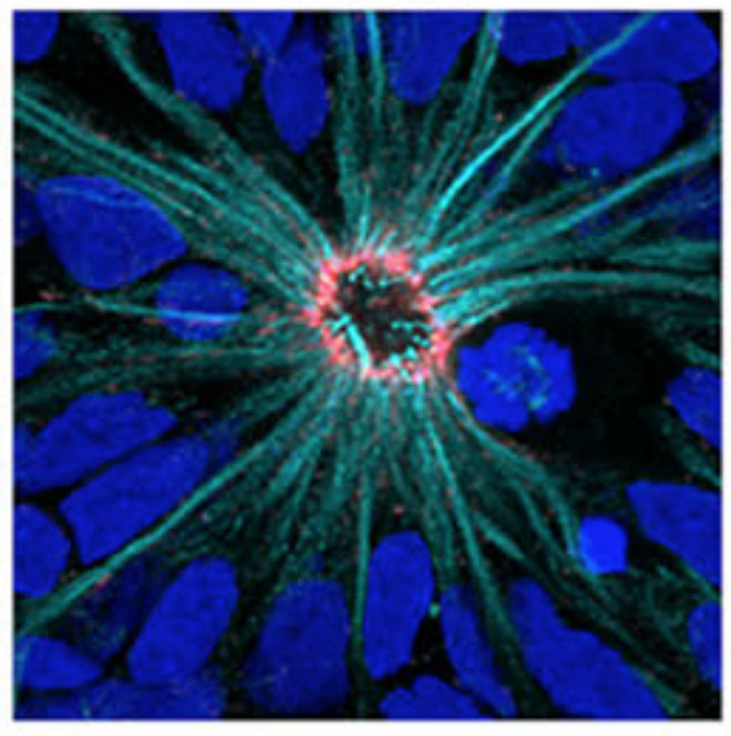 'Neural rosettes' grown in a dish showed some interesting changes when the HD gene was mutated--or when there was no HD gene at all